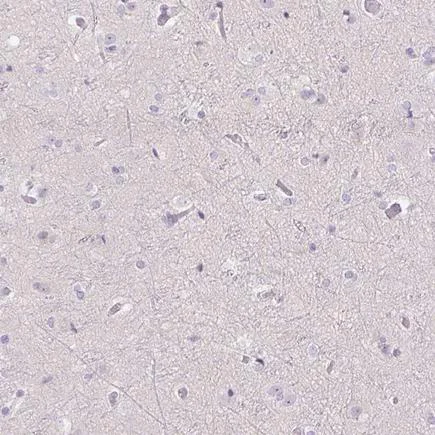 Immunohistochemistry (Formalin/PFA-fixed paraffin-embedded sections) - Anti-Uroplakin II/UPII antibody (AB204756)