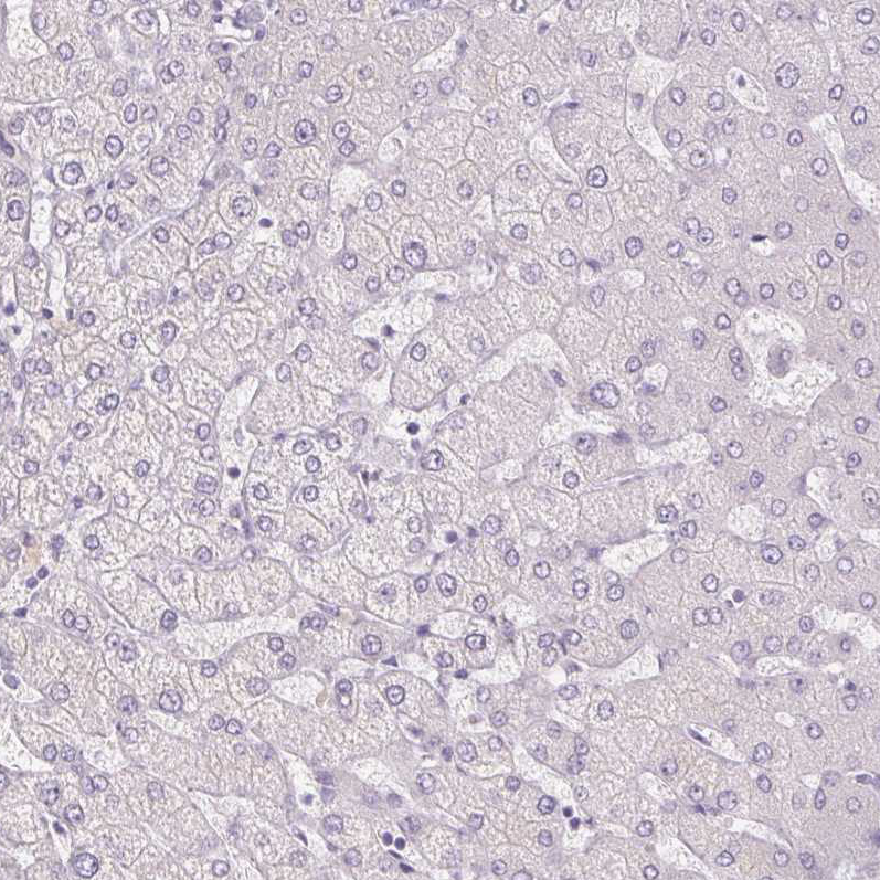 Immunohistochemistry (Formalin/PFA-fixed paraffin-embedded sections) - Anti-Uroplakin II/UPII antibody (AB204756), expandable thumbnail