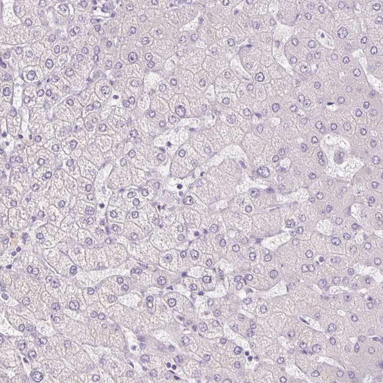 Immunohistochemistry (Formalin/PFA-fixed paraffin-embedded sections) - Anti-Uroplakin II/UPII antibody (AB204756)