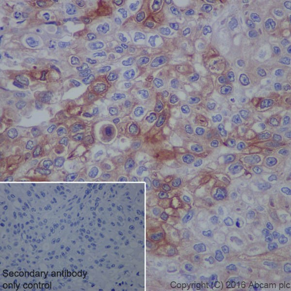 Immunohistochemistry (Formalin/PFA-fixed paraffin-embedded sections) - Anti-Uroplakin II/UPII antibody [EPR18799] (AB213655)