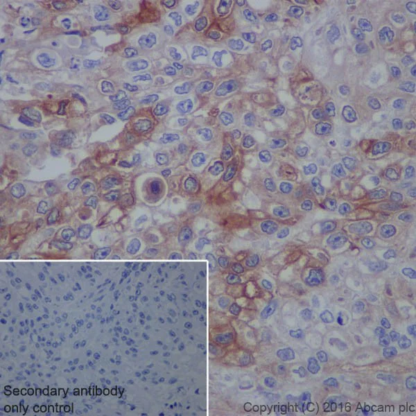 Immunohistochemistry (Formalin/PFA-fixed paraffin-embedded sections) - Anti-Uroplakin II/UPII antibody [EPR18799] (AB213655)
