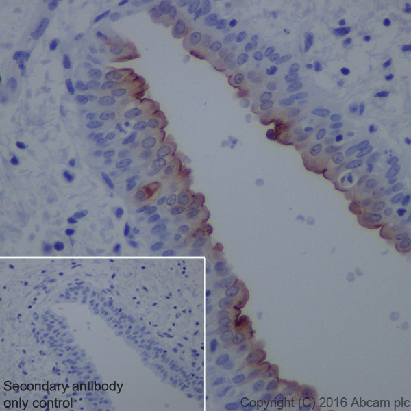 Immunohistochemistry (Formalin/PFA-fixed paraffin-embedded sections) - Anti-Uroplakin II/UPII antibody [EPR18799] (AB213655)
