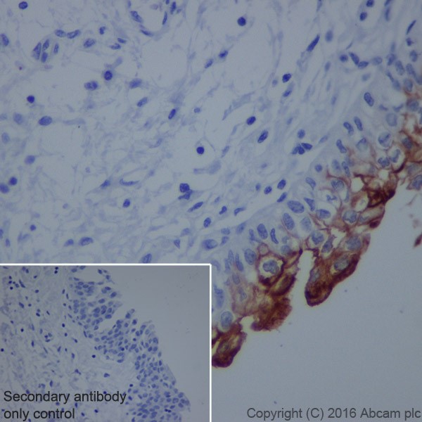 Immunohistochemistry (Formalin/PFA-fixed paraffin-embedded sections) - Anti-Uroplakin II/UPII antibody [EPR18799] (AB213655)