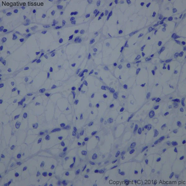 Immunohistochemistry (Formalin/PFA-fixed paraffin-embedded sections) - Anti-Uroplakin II/UPII antibody [EPR18799] - BSA and Azide free (AB224261)