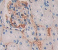 Immunohistochemistry (Formalin/PFA-fixed paraffin-embedded sections) - Anti-Uroplakin III antibody (AB231576)