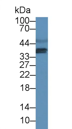 Western blot - Anti-Uroplakin III antibody (AB231576)