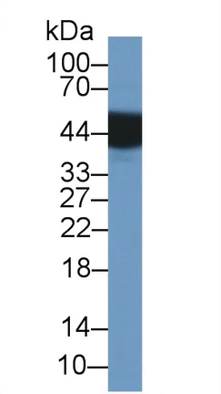 Western blot - Anti-Uroplakin III antibody (AB231576)