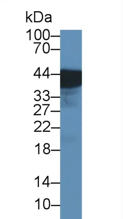 Western blot - Anti-Uroplakin III antibody (AB231576)