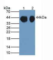 Western blot - Anti-Uroplakin III antibody (AB231576)