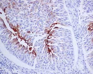 Immunohistochemistry (Formalin/PFA-fixed paraffin-embedded sections) - Anti-Uroplakin III antibody [EPR14420] (AB187646)