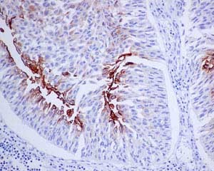 Immunohistochemistry (Formalin/PFA-fixed paraffin-embedded sections) - Anti-Uroplakin III antibody [EPR14420] - BSA and Azide free (AB239006)