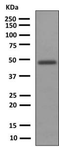 Western blot - Anti-Uroplakin III antibody [EPR3612(2)] (AB150409)