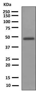 Western blot - Anti-Uroplakin III antibody [EPR3612(2)] (AB150409)
