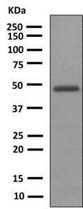 Western blot - Anti-Uroplakin III antibody [EPR3612(2)] - BSA and Azide free (AB248974), expandable thumbnail