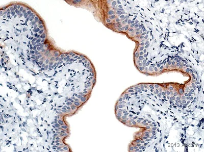 Immunohistochemistry (Formalin/PFA-fixed paraffin-embedded sections) - Anti-Uroplakin III antibody [SFI-1] (AB78196)