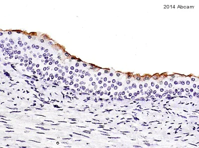 Immunohistochemistry (Formalin/PFA-fixed paraffin-embedded sections) - Anti-Uroplakin III antibody [SFI-1] (AB78196)