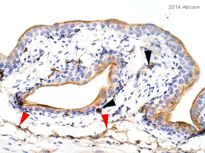 Immunohistochemistry (Formalin/PFA-fixed paraffin-embedded sections) - Anti-Uroplakin III antibody [SFI-1] (AB78196)
