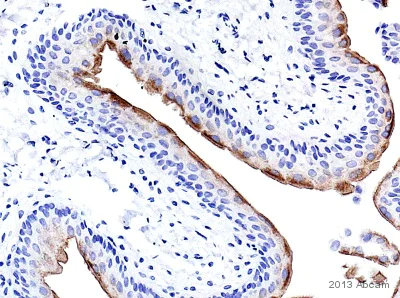 Immunohistochemistry (Formalin/PFA-fixed paraffin-embedded sections) - Anti-Uroplakin III antibody [SFI-1] (AB78196)