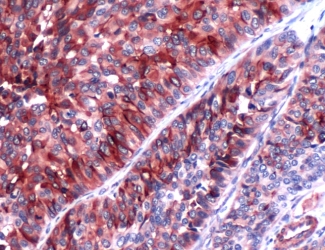 Immunohistochemistry (Formalin/PFA-fixed paraffin-embedded sections) - Anti-Uroplakin III antibody [SP73] (AB93721)