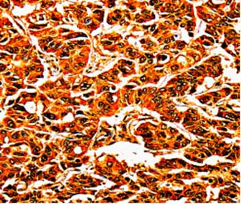Immunohistochemistry (Formalin/PFA-fixed paraffin-embedded sections) - Anti-Uroplakin IIIB antibody (AB197368)