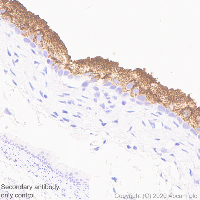 Immunohistochemistry (Formalin/PFA-fixed paraffin-embedded sections) - Anti-Uroplakin IIIB antibody [C362] (AB237778)