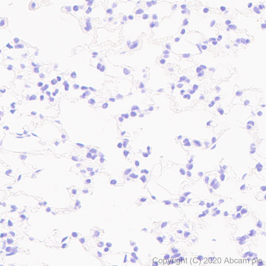 Immunohistochemistry (Formalin/PFA-fixed paraffin-embedded sections) - Anti-Uroplakin IIIB antibody [C362] - BSA and Azide free (AB255744), expandable thumbnail
