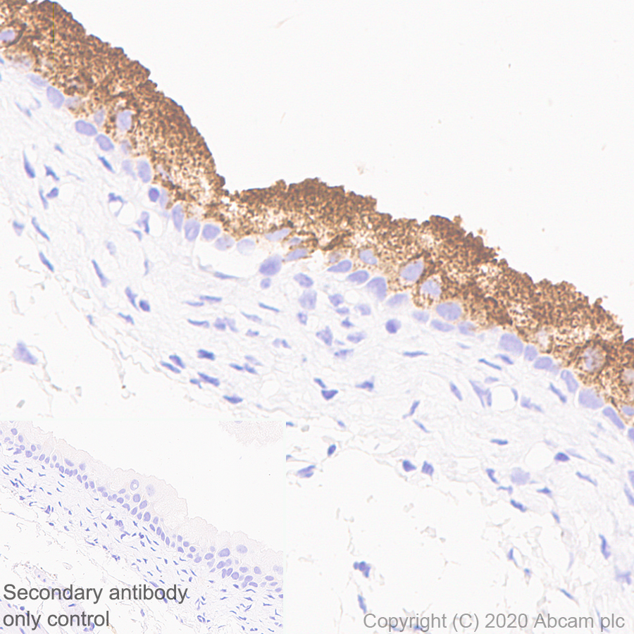Immunohistochemistry (Formalin/PFA-fixed paraffin-embedded sections) - Anti-Uroplakin IIIB antibody [C362] - BSA and Azide free (AB255744), expandable thumbnail