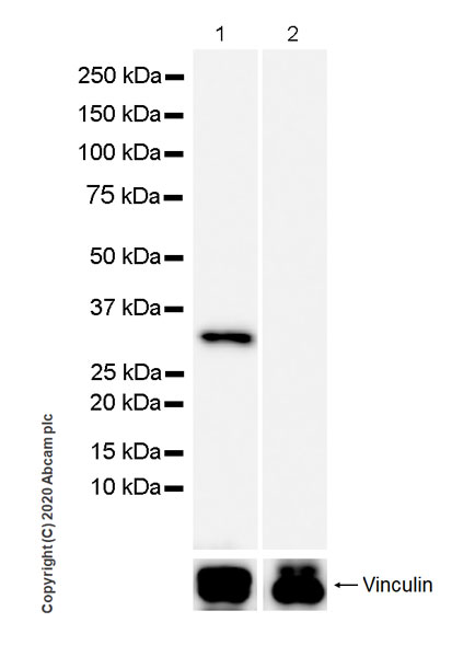 Western blot - Anti-Uroplakin IIIB antibody [C362] - BSA and Azide free (AB255744), expandable thumbnail