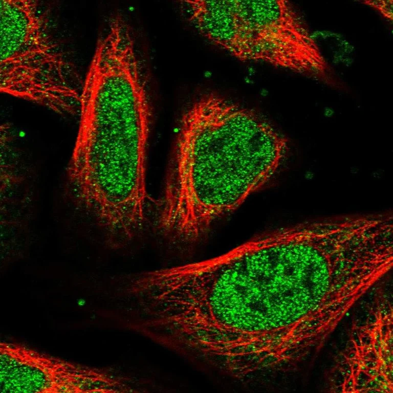 Immunocytochemistry/ Immunofluorescence - Anti-UROS antibody (AB252955)
