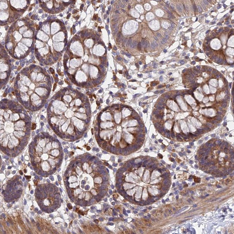 Immunohistochemistry (Formalin/PFA-fixed paraffin-embedded sections) - Anti-UROS antibody (AB252955)