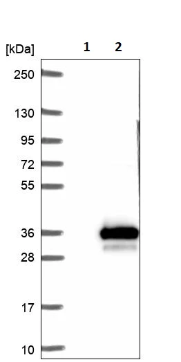 Western blot - Anti-UROS antibody (AB252955)