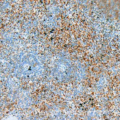 Immunohistochemistry (Formalin/PFA-fixed paraffin-embedded sections) - Anti-URP2/Kindlin-3 antibody [3D6] (AB173416)