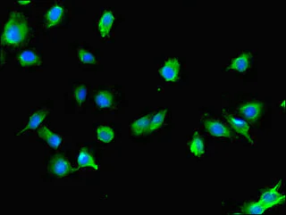 Immunocytochemistry/ Immunofluorescence - Anti-Use1 antibody (AB234867)