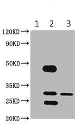 Immunoprecipitation - Anti-Use1 antibody (AB234867), expandable thumbnail
