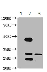 Immunoprecipitation - Anti-Use1 antibody (AB234867)