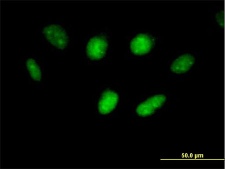Immunocytochemistry/ Immunofluorescence - Anti-USF1 antibody (AB167693), expandable thumbnail