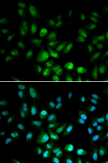 Immunocytochemistry/ Immunofluorescence - Anti-USF1 antibody (AB180717)
