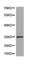 Western blot - Anti-USF1 antibody (AB180717)