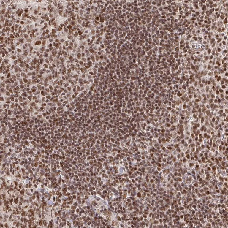 Immunohistochemistry (Formalin/PFA-fixed paraffin-embedded sections) - Anti-USF1 Antibody (AB327226)