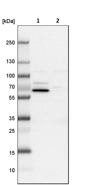Western blot - Anti-USH1C/Harmonin antibody (AB244404)