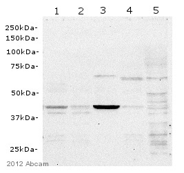 Western blot - Anti-USH1C/Harmonin antibody [EPR8131] (AB133763)