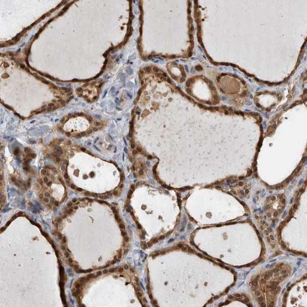 Immunohistochemistry (Formalin/PFA-fixed paraffin-embedded sections) - Anti-USH1G antibody (AB150820)