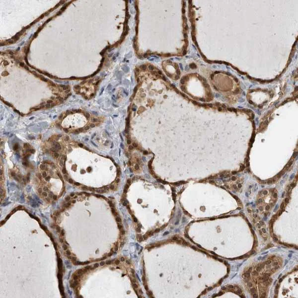 Immunohistochemistry (Formalin/PFA-fixed paraffin-embedded sections) - Anti-USH1G antibody (AB150820)