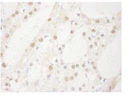 Immunohistochemistry (Formalin/PFA-fixed paraffin-embedded sections) - Anti-USP1 antibody (AB84772)