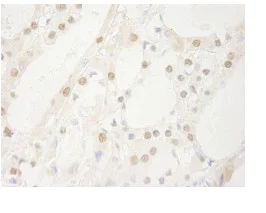 Immunohistochemistry (Formalin/PFA-fixed paraffin-embedded sections) - Anti-USP1 antibody (AB84772)