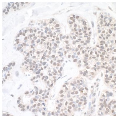 Immunohistochemistry (Formalin/PFA-fixed paraffin-embedded sections) - Anti-USP10 antibody (AB70895), expandable thumbnail