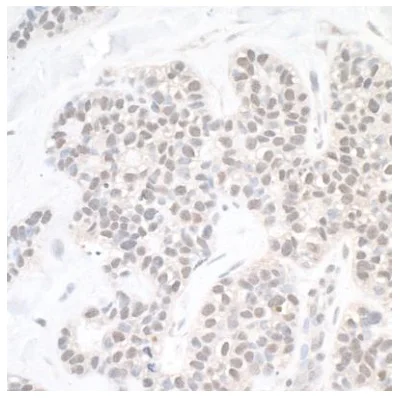 Immunohistochemistry (Formalin/PFA-fixed paraffin-embedded sections) - Anti-USP10 antibody (AB70895)