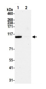 Immunoprecipitation - Anti-USP10 antibody (AB70895), expandable thumbnail