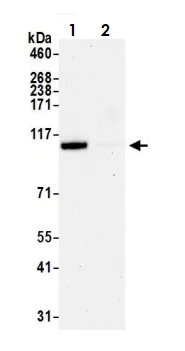 Immunoprecipitation - Anti-USP10 antibody (AB70895)