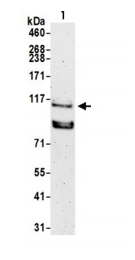 Western blot - Anti-USP10 antibody (AB70895), expandable thumbnail